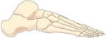 A lateral view of the ankle in question.